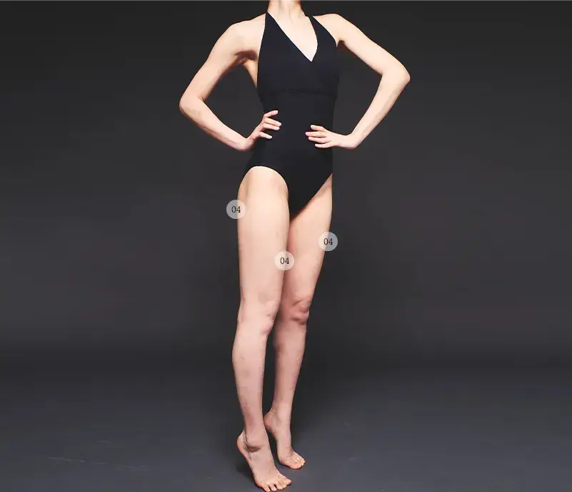 전신 사진에서 04번 시술 부위(허벅지)를 표시한 모습