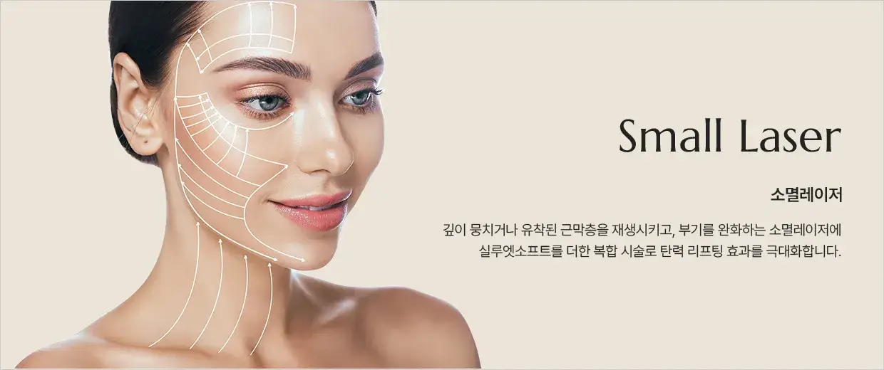 소멸레이저(Small Laser) 안내 — 뭉친 근막층을 재생시키고 부기를 완화하는 복합 시술