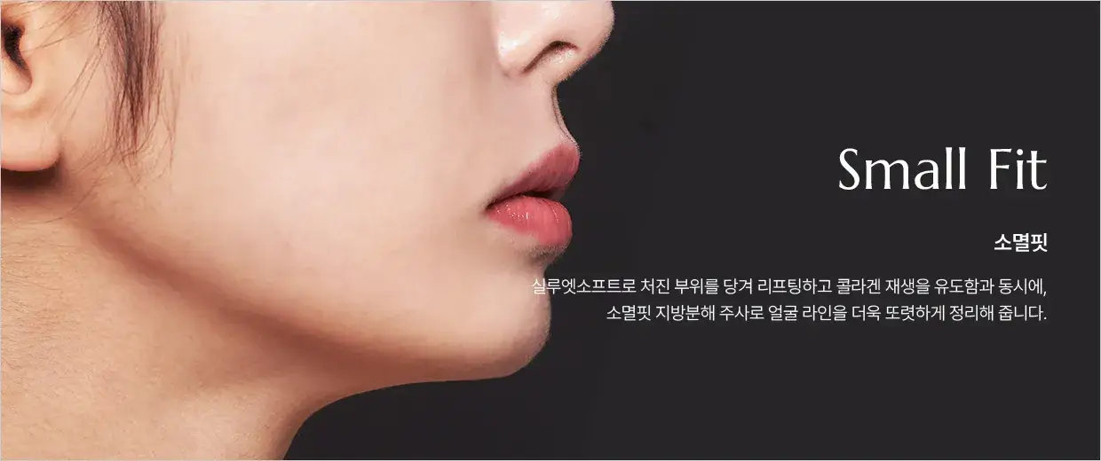 소멸핏(Small Fit) 안내 — 실루엣소프트로 당겨 올리고 지방분해 주사로 윤곽을 정리하는 복합 시술