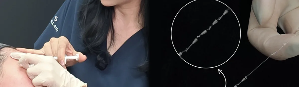 [의학 칼럼] 리프팅을 해도 아쉬운 이유? 얼굴의 구조를 고려한 ‘구조리프팅’ (3/10)