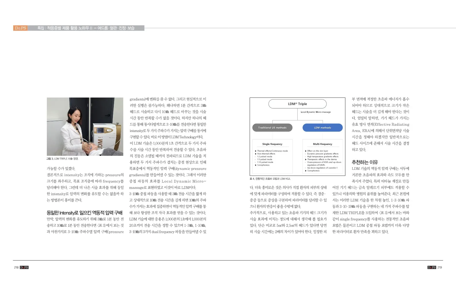 D&PS | 트리플엘디엠 초음파 시술 (3/3)