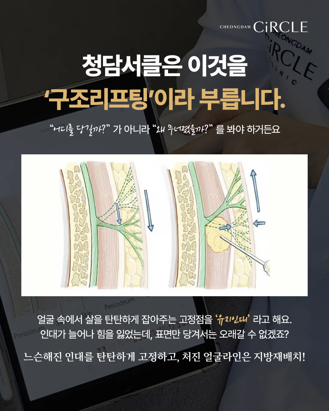 [의학 칼럼] 리프팅을 해도 아쉬운 이유? 얼굴의 구조를 고려한 ‘구조리프팅’ (7/10)