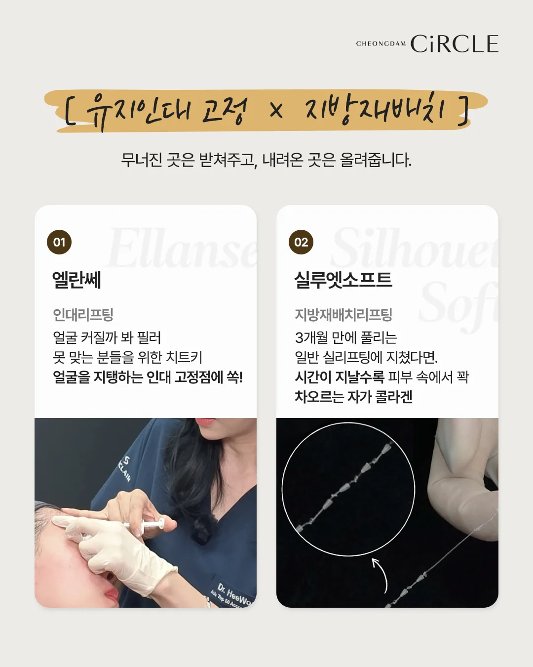 [의학 칼럼] 리프팅을 해도 아쉬운 이유? 얼굴의 구조를 고려한 ‘구조리프팅’ (8/10)